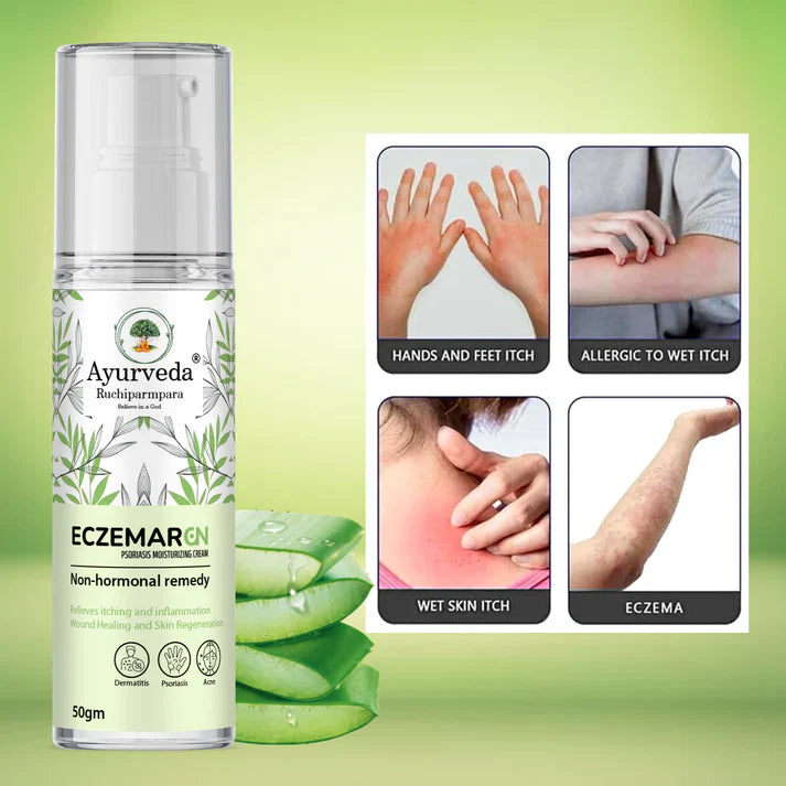 Eczemar GN – Ayurvedic Psoriasis & Eczema Moisturizing Cream