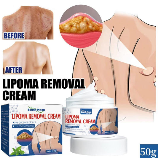 Natural Lipoma Removal Cream | Free Home Delivery
